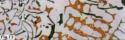 gray iron w/binary ferrite-iron phosphide eutectic 100x